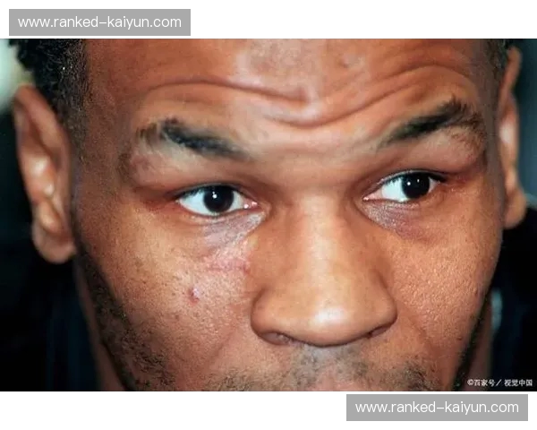 世纪之战：泰森vs.凯恩，拳击史上的璀璨碰撞